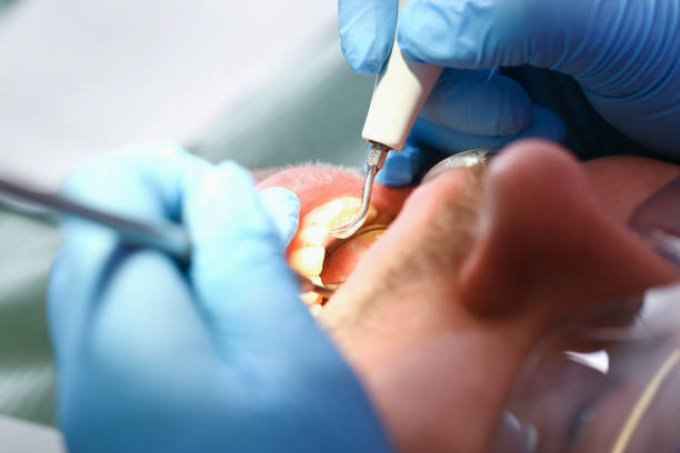 Best Urgent Care for Lost Fillings or Crowns in Mazomanie, WI