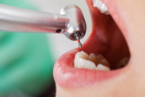 Best Emergency Treatment for Dental Infections or Abscesses in Mazomanie, WI